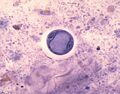 Entamoeba coli 01