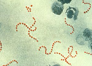 Archivo:Streptococcus pyogenes