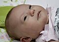 Trisomy 21 - Down Syndrome - Kennedi Beahn - presented by Kraig Beahn