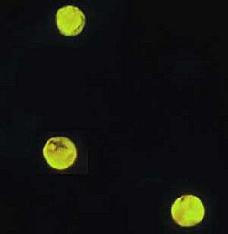 Cryptosporidium parvum auramine-rhodamine labeled.jpg