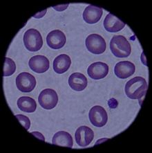Archivo:Blood cells 090304-F-5951M-108
