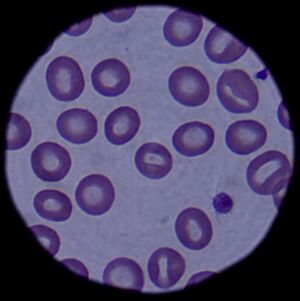 Archivo:Blood cells 090304-F-5951M-108