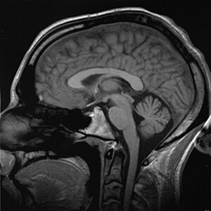 Archivo:Brain chrischan