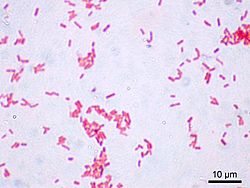Archivo:Escherichia coli Gram