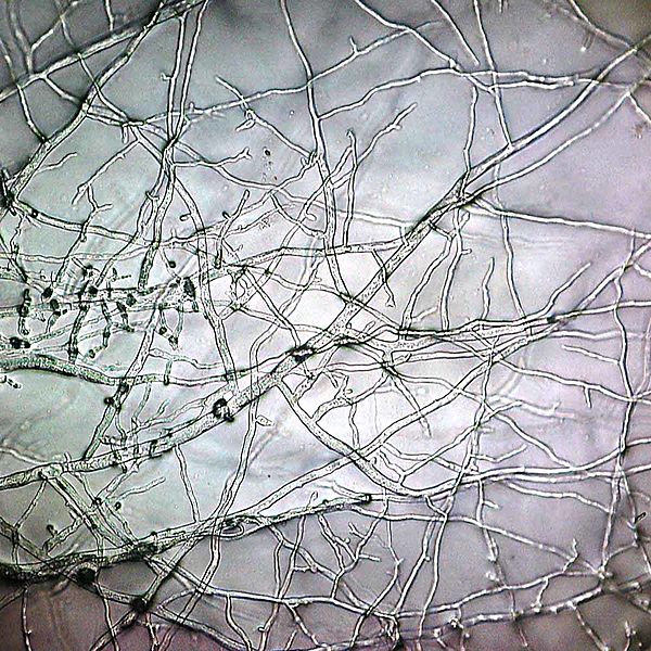 20100815 1818 Mold