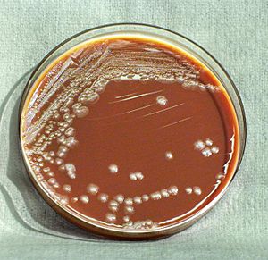 Archivo:Yersinia pestis HHS