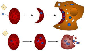 Archivo:Sickle Cell Anemia and its Protection Against Malaria