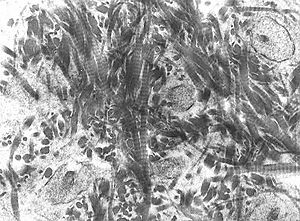 Archivo:Woven bone matrix