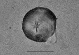 Archivo:Almidon arqueologico de Zamia amblyphyllidia Artef. 4. UTU-27