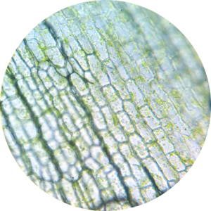 Archivo:Elodea chloroplasts 5 400×