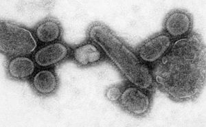 Archivo:Reconstructed Spanish Flu Virus