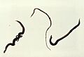 Schistosoma mansoni trematodes