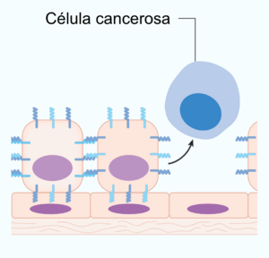 Archivo:Diagram showing a cancer cell which has lost its ability to stick to other cells CRUK 057 esp