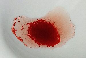 Archivo:Reacción de aglutinación (cropped)