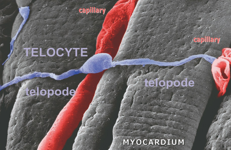 Telocytes - Fig 10