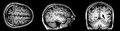 BrainMRI3planes