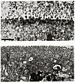 Rotavirus infected gut