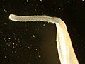Acanthocephala Rhadinorhynchus 2