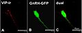 Celula hipotal GnRH