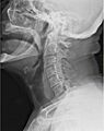 Medical X-Ray imaging EJE04 nevit