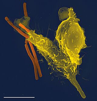 Neutrophil with anthrax copy.jpg