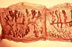 Archivo:Taenia solium tapeworm proglottids 5261 lores