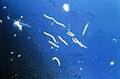 Borrelia burgdorferi (CDC-PHIL -6631) lores
