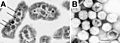 Carboxysomes EM