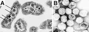 Archivo:Carboxysomes EM