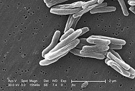 Mycobacterium tuberculosis 8438 lores