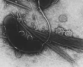 Archivo:Vibrio cholerae