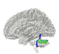 Inferior Cerebellar Peduncle