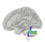 Archivo:Inferior Cerebellar Peduncle