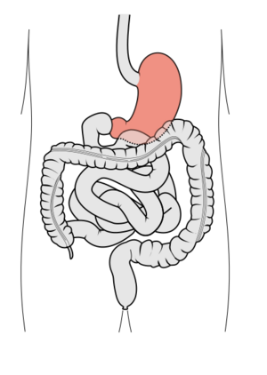 Archivo:Tractus intestinalis ventriculus