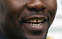 Diastema-echt.JPG