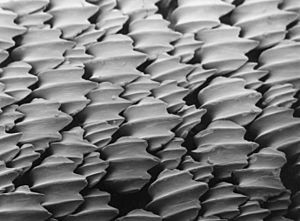 Archivo:Denticules cutanés du requin citron Negaprion brevirostris vus au microscope électronique à balayage