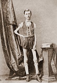 Isaac W Sprague, living skeleton, 1867.jpg