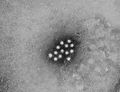 Hepatitis A virus 01
