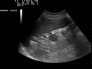 Archivo:Ultrasound Scan ND 110301160450 1605470
