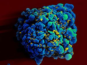 Archivo:HIV-infected H9 T cell